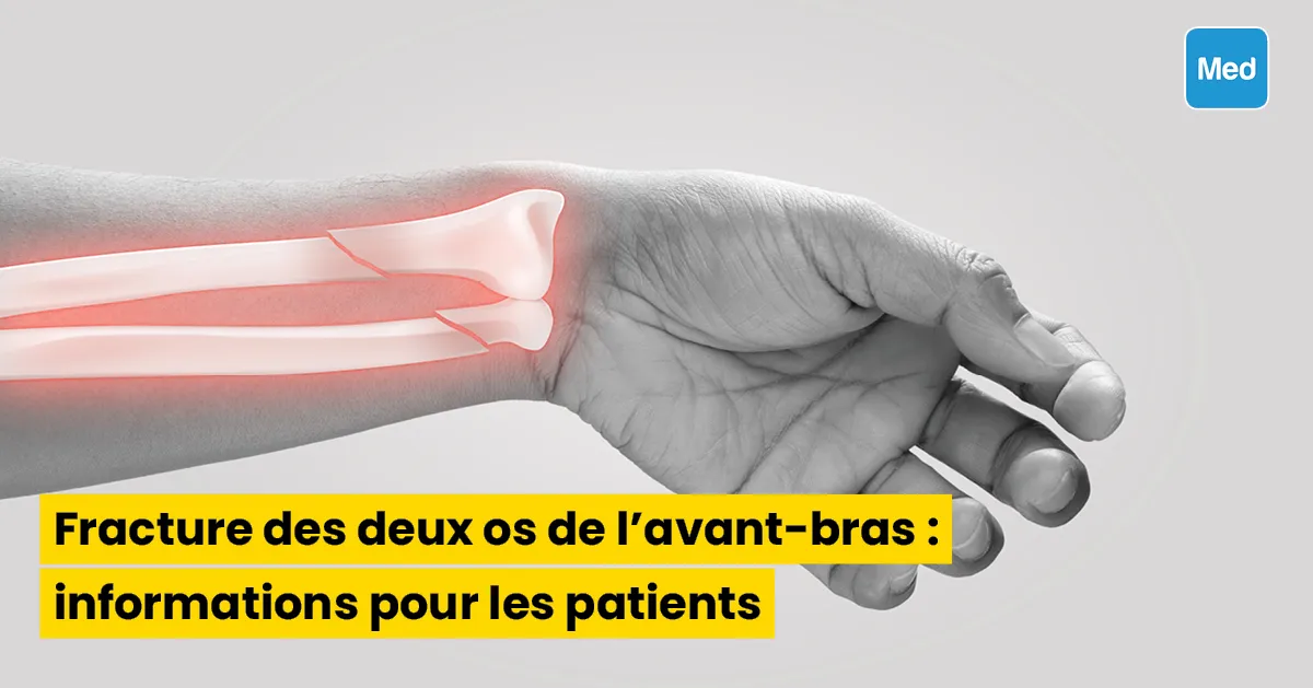 Fracture des deux os de l'avant-bras : informations pour les patients